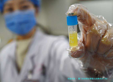 厦门妇幼做试管婴儿的费用多少钱？